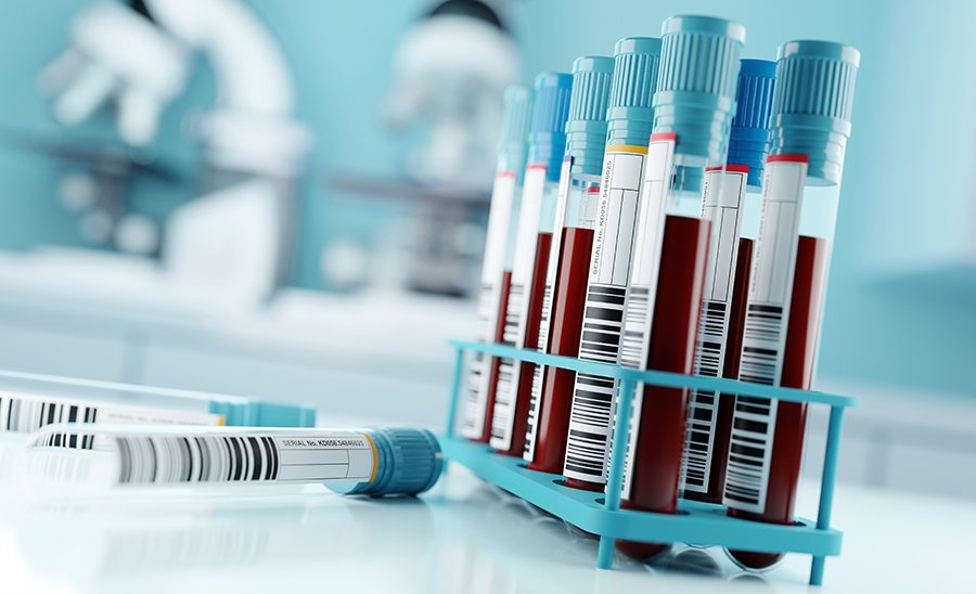 IVD test tubes in hospital laboratory